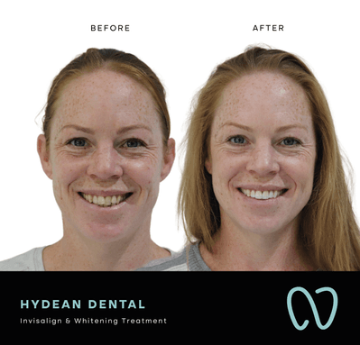 Patient result 3